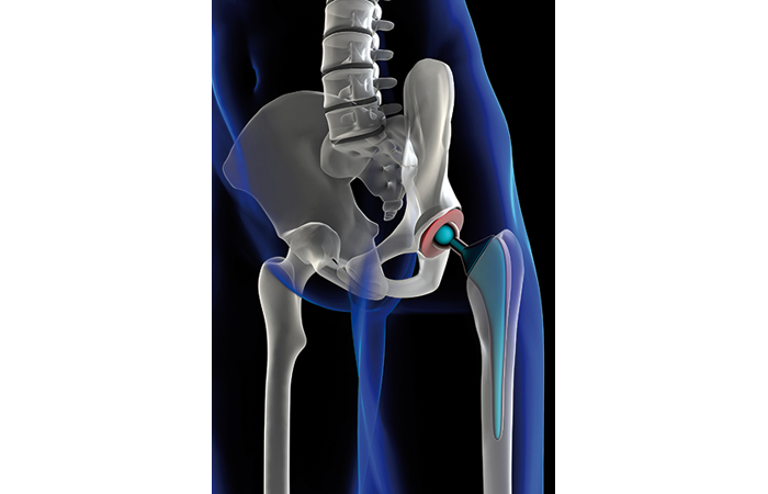 Des verrous à lever pour les dispositifs médicaux