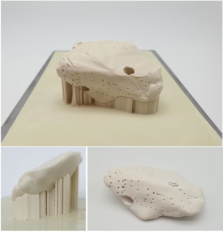 Fabriquer des pièces implantables en céramique