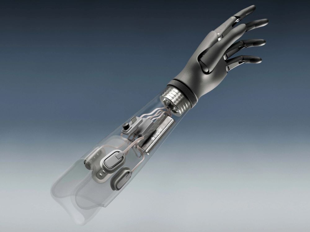 De l’intelligence artificielle entre des mains bioniques
